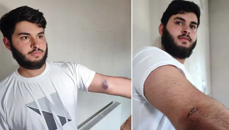Bahçeye Kaçan Top, Mahallede Büyük Kargaşaya Neden Oldu!