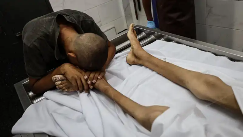 Gazze’de Açlık Faciası: Bir Çocuk Daha Hayata Veda Etti